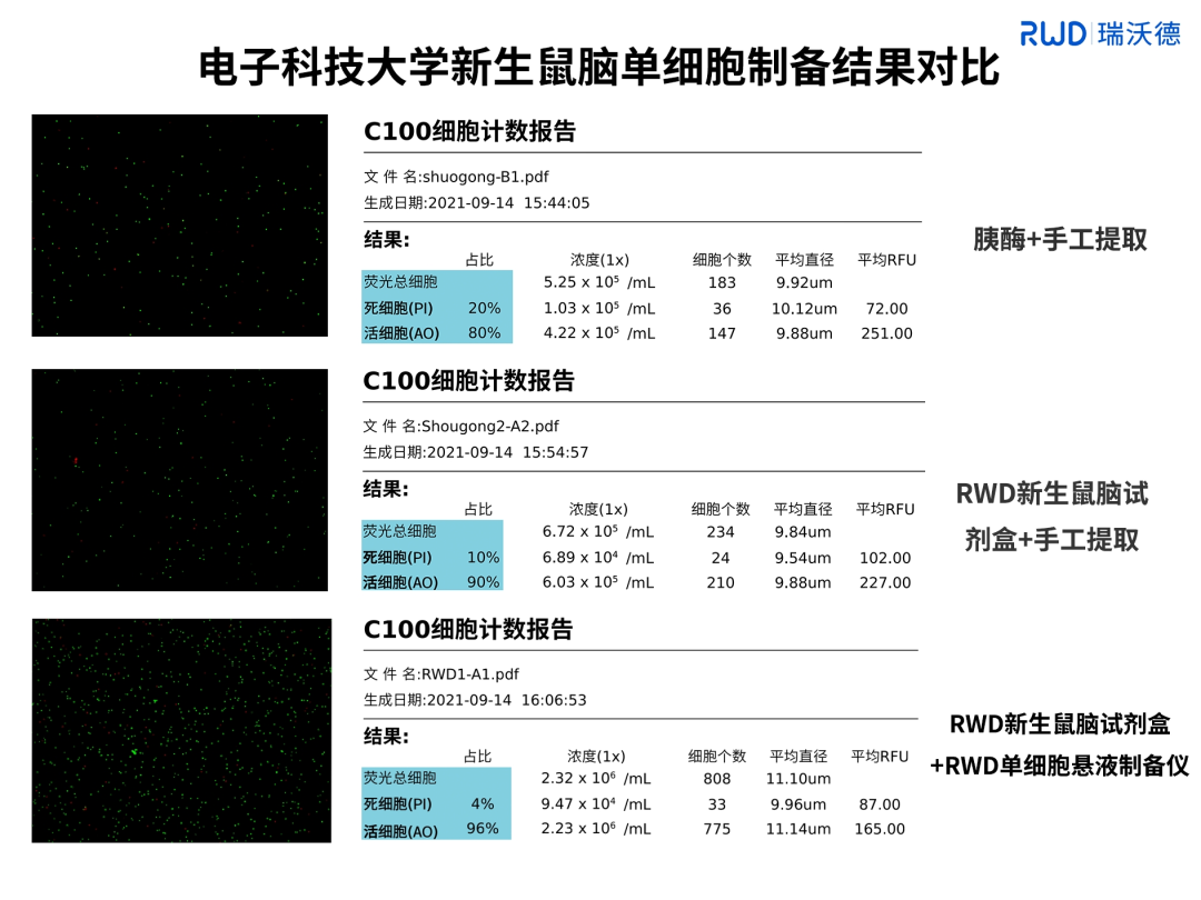 4-电子科技大学新生鼠脑单细胞制备结果对比.png