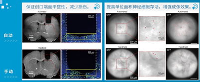 7-组织移除程序2.png