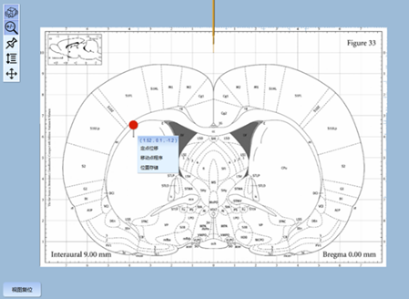 9-探针位置与脑图显示.png
