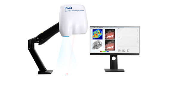 1-激光散斑血流成像系统.jpg